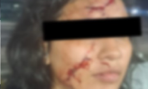 Mulher é atac@da com prato quebrado pelo ex e encontra dificuldades para registrar ocorrência em Manaus