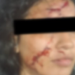Mulher é atac@da com prato quebrado pelo ex e encontra dificuldades para registrar ocorrência em Manaus