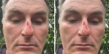 Policial Militar acusa policiais civis de agressã0 no estacionamento da DG em Manaus