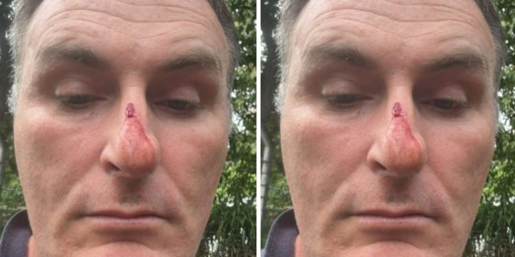 Policial Militar acusa policiais civis de agressã0 no estacionamento da DG em Manaus
