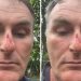 Policial Militar acusa policiais civis de agressã0 no estacionamento da DG em Manaus