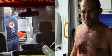 Homem é esf@quead0 no peito após discussã0 com morador de rua no Centro de Manaus