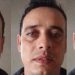 Homem alega que companheira caiu da rede, mas filha denuncia por tentativa de feminicídi0 em Manaus