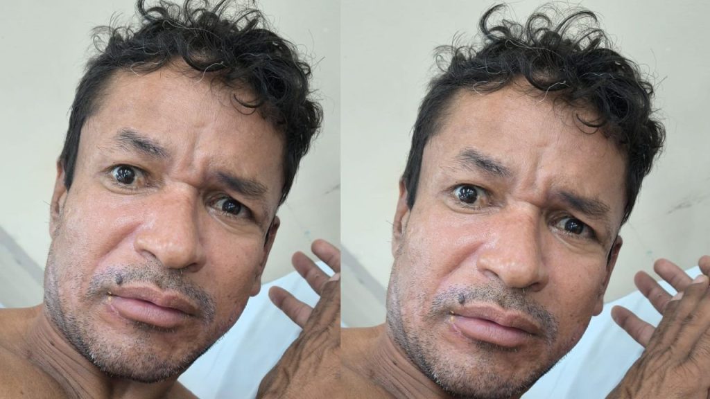 Paciente internado após atropelamento está sem família e hospital faz apelo em Manaus