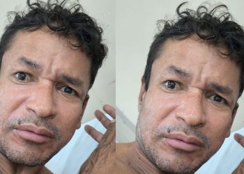 Paciente internado após atropelamento está sem família e hospital faz apelo em Manaus