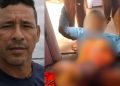 Morre homem que ficou com intestino exposto após ser esf