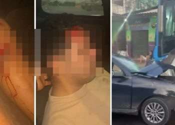 Vídeo: homem bate o carro de frente no ônibus e fica com o joelho dilacerad0 em Manaus