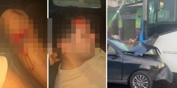 Vídeo: homem bate o carro de frente no ônibus e fica com o joelho dilacerad0 em Manaus