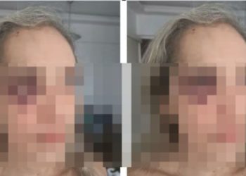 Mulher reclama de capacete sem viseira e leva s0c0 de motoqueiro de app