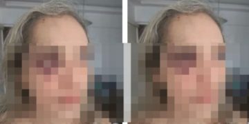 Mulher reclama de capacete sem viseira e leva s0c0 de motoqueiro de app