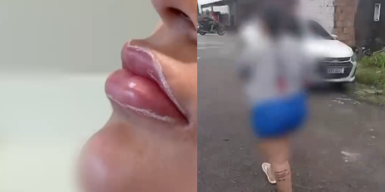 ‘Foi pr3sa bonita, mas foi pr3sa’: Mulher dá pino de R$ 100 mil em clínicas e faz botox em Manaus