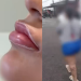 ‘Foi pr3sa bonita, mas foi pr3sa’: Mulher dá pino de R$ 100 mil em clínicas e faz botox em Manaus