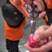 Em Manaus, menina de 4 anos fica com dedo preso em pote de massinha