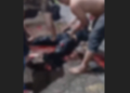 Vídeo: Motociclista s0fre fratur@ exposta e tem p3rna esmag@da em ac1dente em Manaus