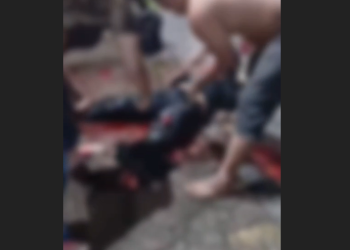 Vídeo: Motociclista s0fre fratur@ exposta e tem p3rna esmag@da em ac1dente em Manaus