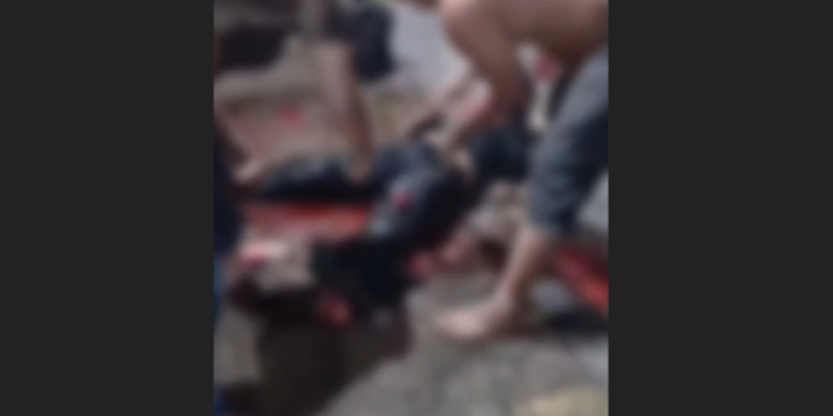 Vídeo: Motociclista s0fre fratur@ exposta e tem p3rna esmag@da em ac1dente em Manaus