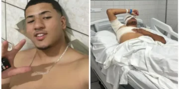 Homem descumpre medida protetiva e leva água f3rvente da ex-companheira