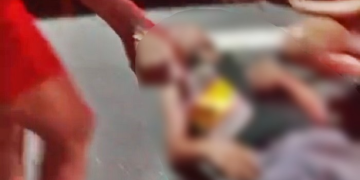 Veja: Motociclista quase tem o pé ‘t0rad0’ ao atingir micro-ônibus na avenida Brasil