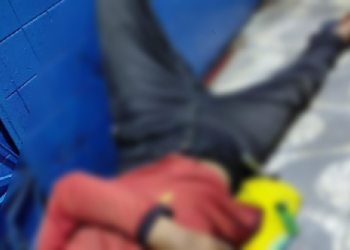 At@que a f@ca deixa homem grav3mente f3rido em via pública de Maués