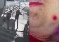 Vídeo mostra momento em que jovem autista é baleada após sorrir para homem