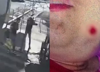 Vídeo mostra momento em que jovem autista é baleada após sorrir para homem