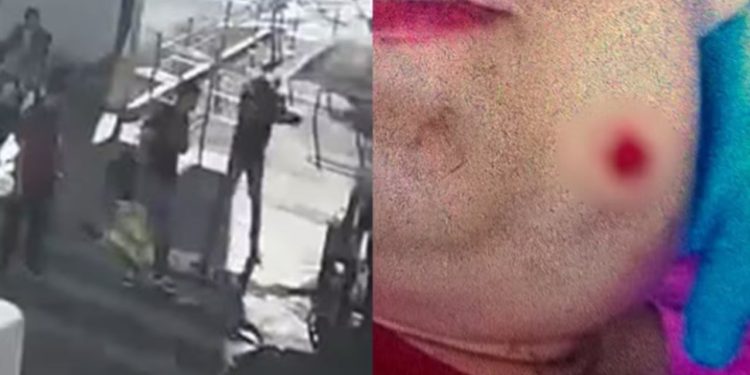 Vídeo mostra momento em que jovem autista é baleada após sorrir para homem