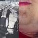 Vídeo mostra momento em que jovem autista é baleada após sorrir para homem