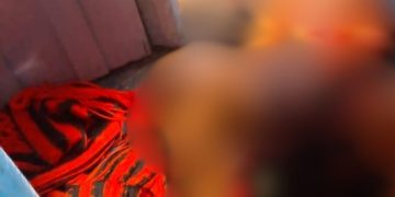 Homem leva fac4da no abdômen após c0nfusão com companheira em Maués