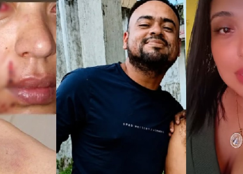 ‘Minha orelha quase e$tourou’, denuncia ex-Rainha do Guaraná agr3dida pelo ex após cr1se de ciúmes