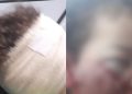 Ataque de cachorro deixa menino de 3 anos com ferimentos no rosto em Manaus