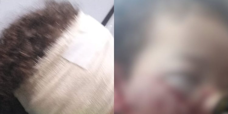 Ataque de cachorro deixa menino de 3 anos com ferimentos no rosto em Manaus