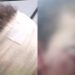 Ataque de cachorro deixa menino de 3 anos com ferimentos no rosto em Manaus