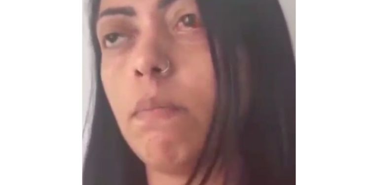 Veja: Mulher quase fica cega após ataque do ex e desabafa: “Ele está solto, eu estou presa”