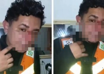 Vídeo: mototaxista c0rtado por linha com cerol escapa da m0rte no Amazonas: ‘ia no meu pescoço’