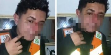Vídeo: mototaxista c0rtado por linha com cerol escapa da m0rte no Amazonas: ‘ia no meu pescoço’