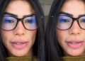 Marciele Albuquerque é diagnosticada com alopecia emocional