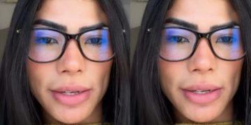 Marciele Albuquerque é diagnosticada com alopecia emocional