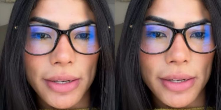 Marciele Albuquerque é diagnosticada com alopecia emocional