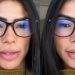 Marciele Albuquerque é diagnosticada com alopecia emocional