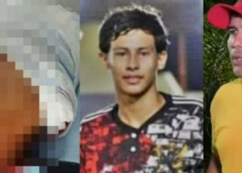 Vídeo: jovem de 15 anos balead0 pelo pai da namorada revela no hospital como foi atacad0
