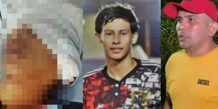 Vídeo: jovem de 15 anos balead0 pelo pai da namorada revela no hospital como foi atacad0