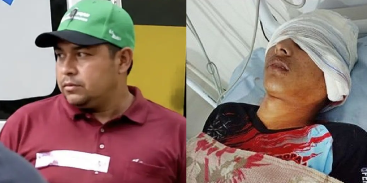 Dono da ‘Adega do Tubarão’ é pr3s0 por dar t1r0 na cabeça de garoto de 15 anos em Maués