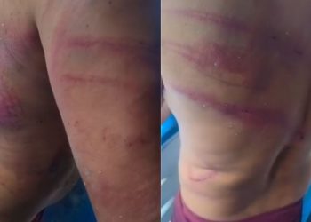 'Piratas dos rios' atacam trabalhador no Solimões e deixam vítima com marcas de violência