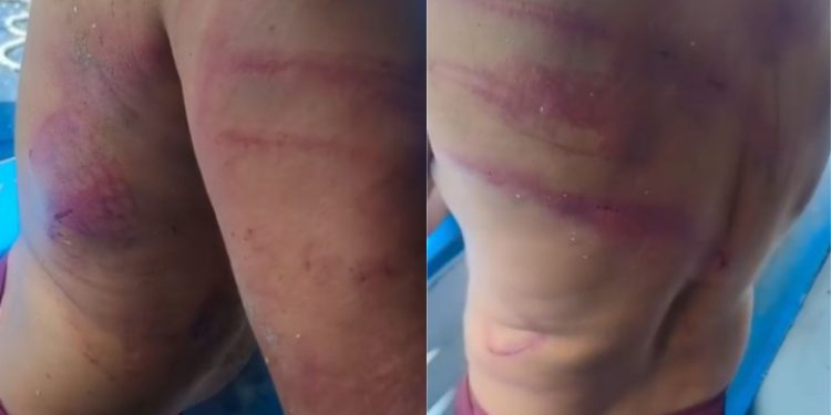 'Piratas dos rios' atacam trabalhador no Solimões e deixam vítima com marcas de violência
