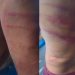 'Piratas dos rios' atacam trabalhador no Solimões e deixam vítima com marcas de violência