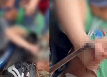 Vídeo forte: menino de 4 anos chora após pedal da moto entrar no pé dele no Amazonas