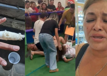 Mãe atípica agr3dida por mulher em shopping de Manaus teve o dedo fr@turad0