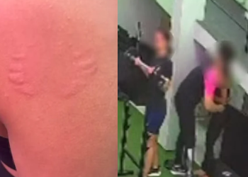 Vídeo: Professora relata assédi0 e registra que1xa após ser m0rdida no ombro em academia