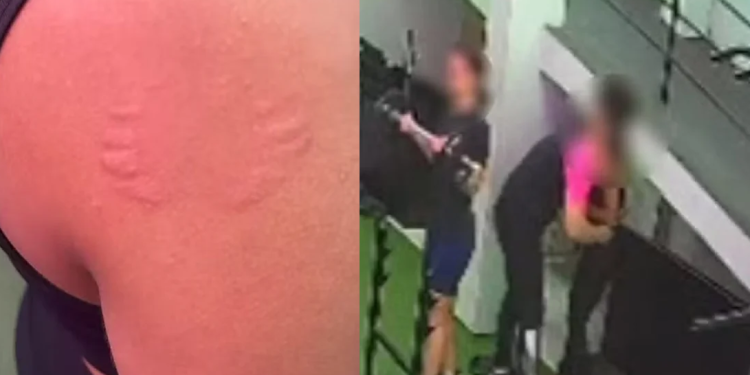 Vídeo: Professora relata assédi0 e registra que1xa após ser m0rdida no ombro em academia