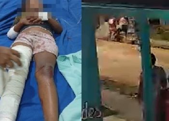 Vídeo: menina de 8 anos é atr0pelada por moto e grita de dor no Amazonas